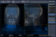 Patient positioning software